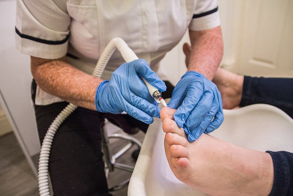 Sue Quinton North Wales podiatrist - at work